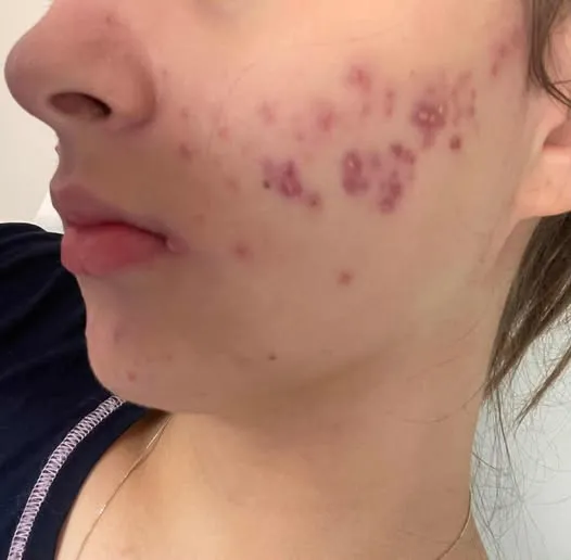 These are the consequences of sleeping with…