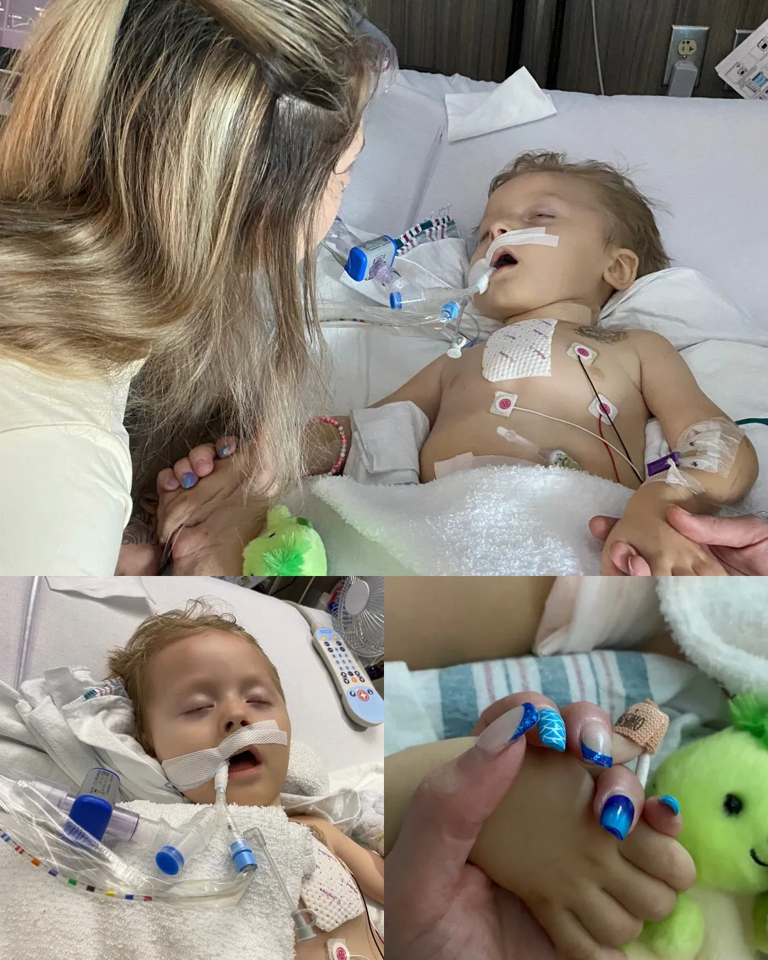 "The Little Warrior Who Refused to Give Up: Brody’s Fight for Every Breath".3611