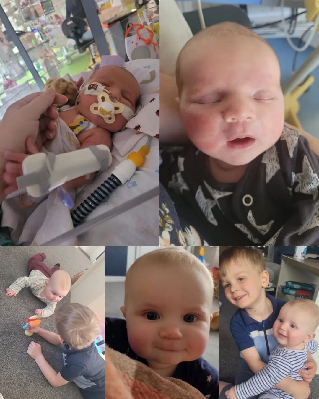 “Toby’s Tiny Heart, Extraordinary Courage” 💙.2128