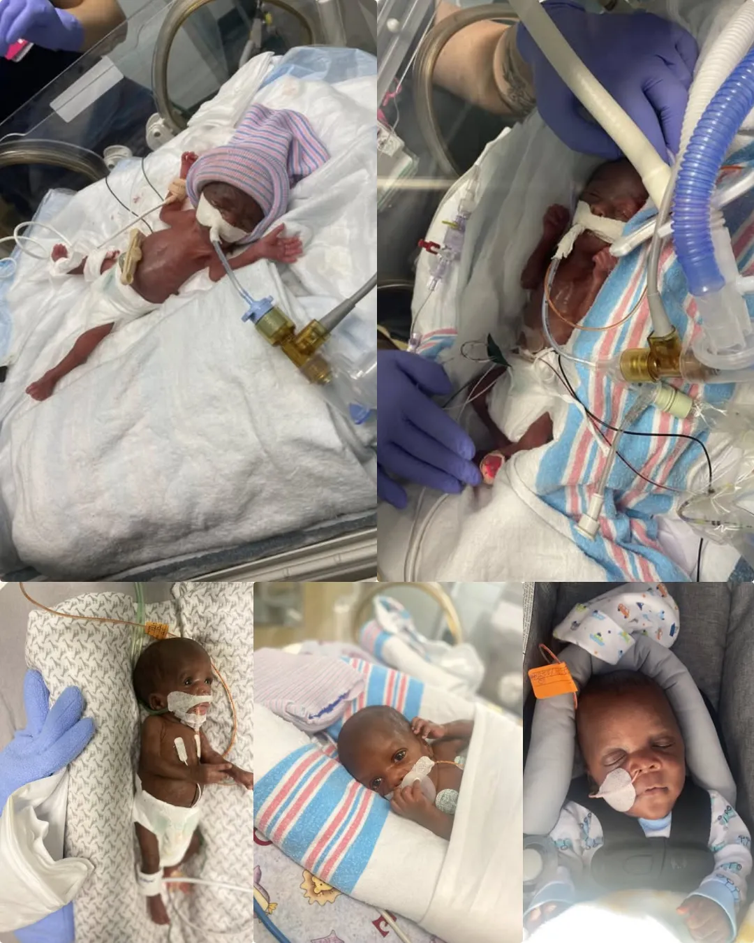 Cayson’s Story: A Miracle Born Too Soon.2183