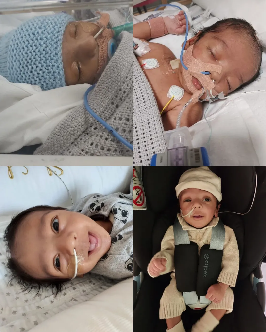 Dylan – A Tiny Heart That Taught a Family Love and Loss.2321
