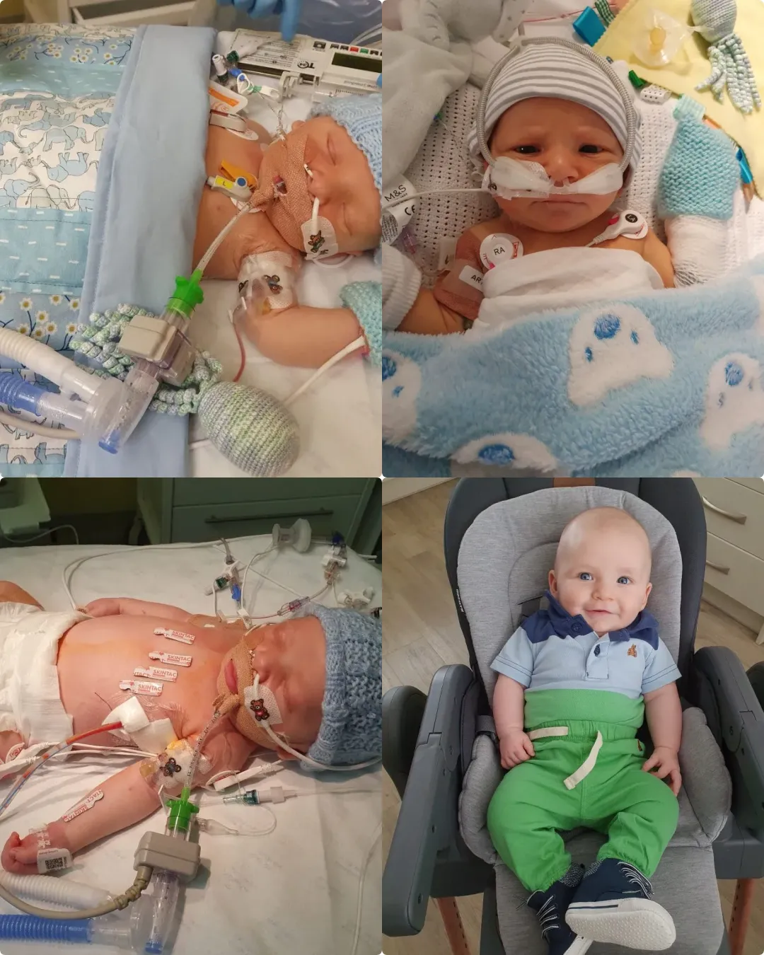 Lucca – The Little Heart Warrior Who Fought Against the Odds ✨.2323