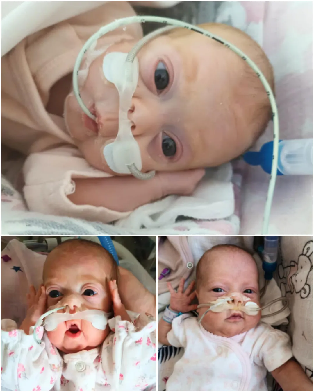 A Miracle at 24 Weeks: Baby Wiktoria's Fight for Life and the Struggles Ahead. 4826