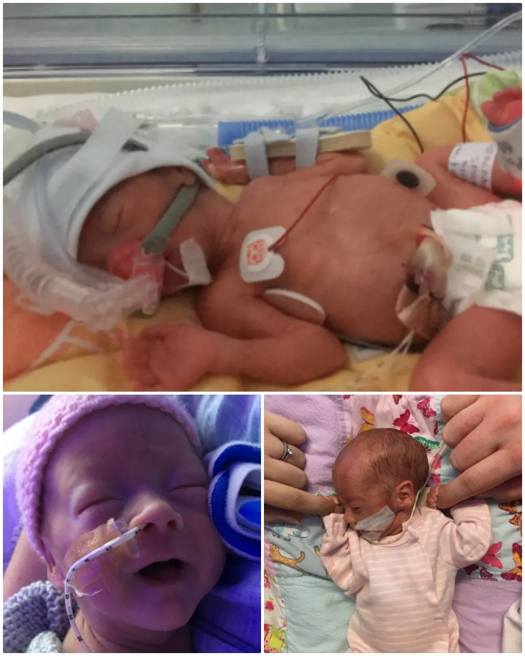 Support in the Darkest Times: How Ronald McDonald House Charities UK Helped Our Family.739