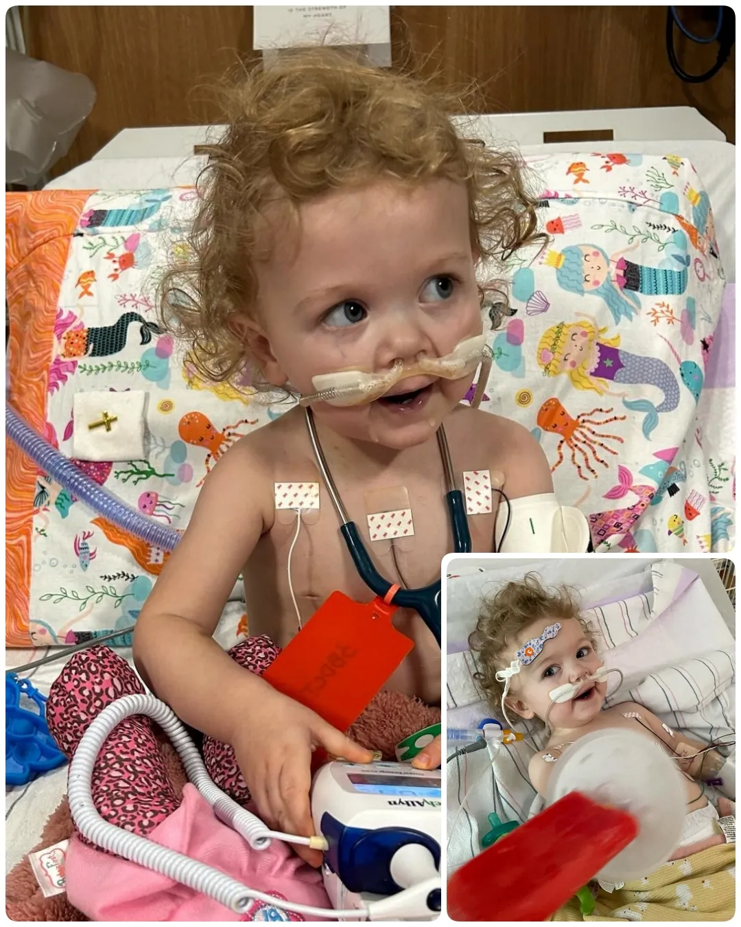 Miley’s Journey: A Remarkable Heart Warrior’s Courage and Resilience in the Fight Against Hypoplastic Left Heart Syndrome.T779
