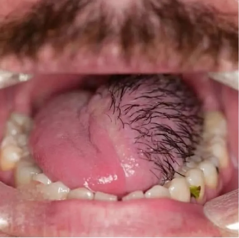 BREAKING Fatal crash on takeoff—crew pronounced dead while…See more psz