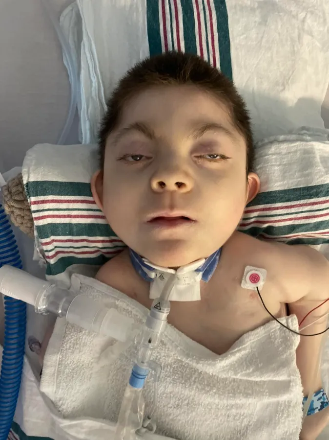 Mceclip40 1760601726 Q80