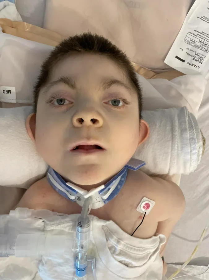 Mceclip41 1760601728 Q80