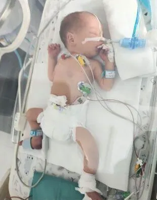 Mceclip57 1760606308 Q80