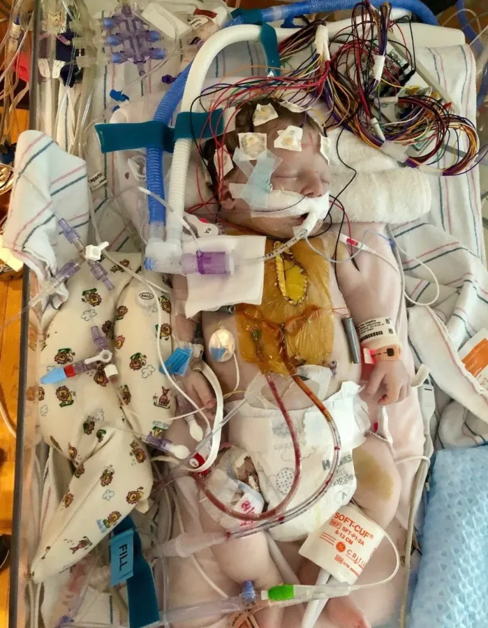 Mceclip18 1761359649 Q80